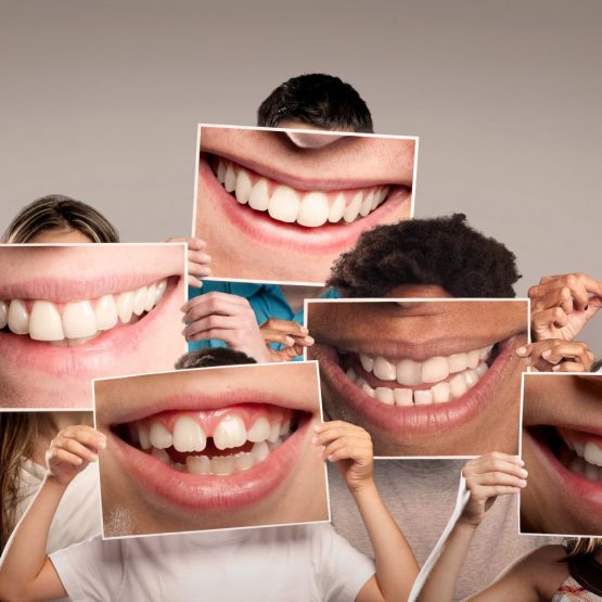 Group of happy people holding a picture of a mouth smiling on a
